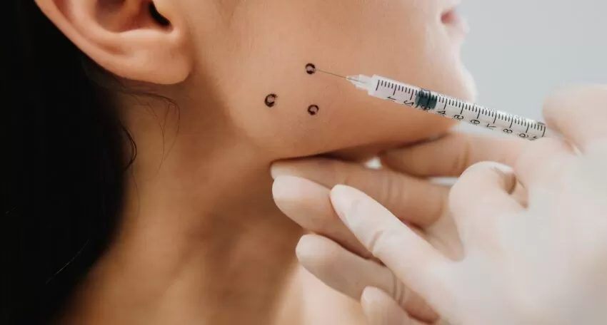 Injektion von Botulinumtoxin in den Kaumuskel bei Bruxismus