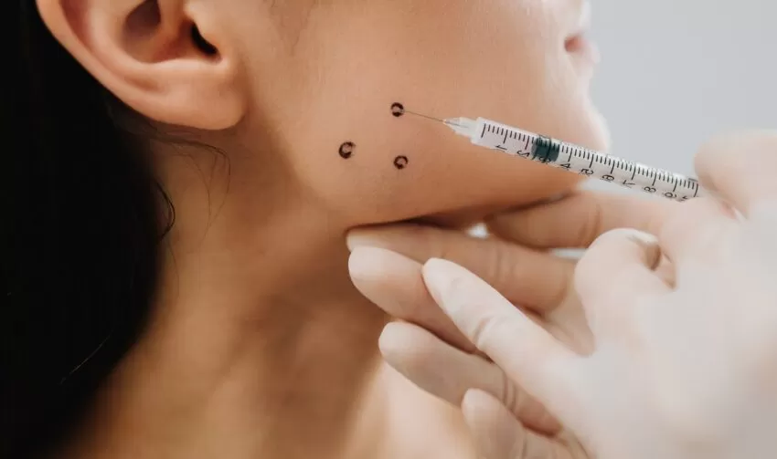 Injektion von Botulinumtoxin in den Kaumuskel bei Bruxismus